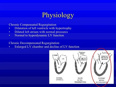 hyperdynamic systolic function treatment.